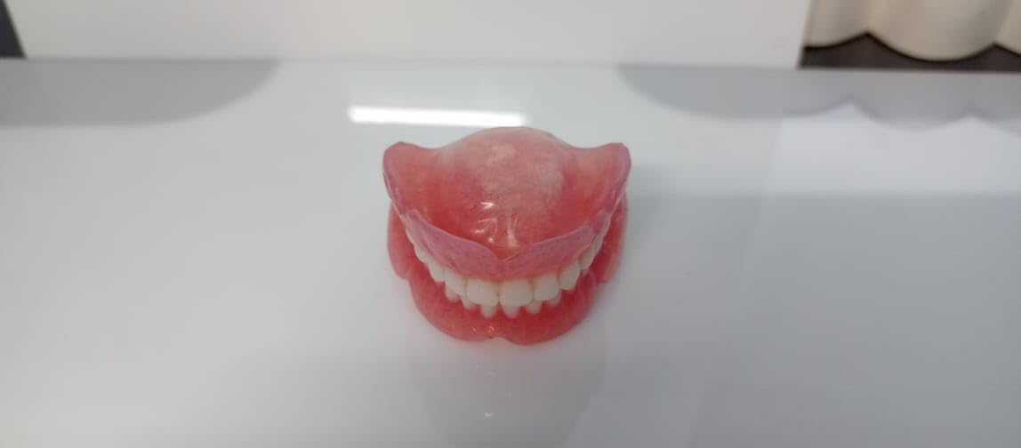 Full Set Upper & Lower Denture S591