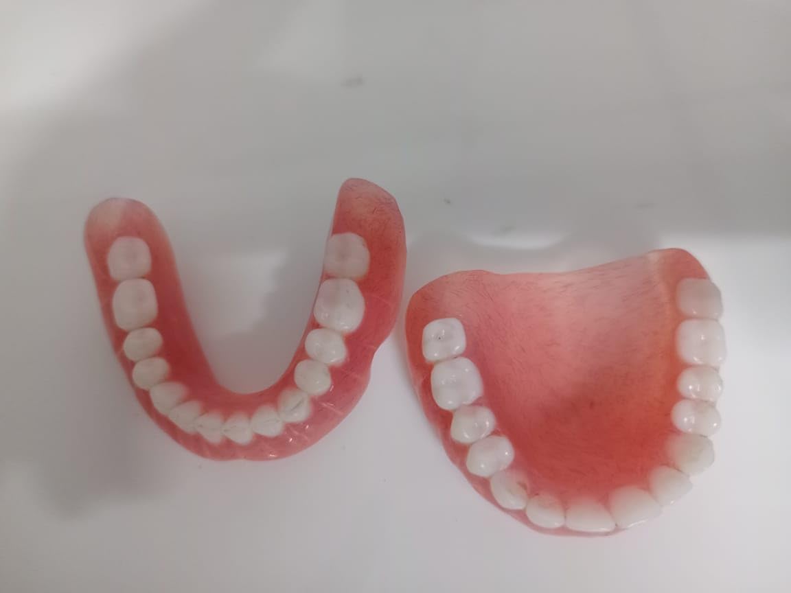 Full Set Upper & Lower Denture S591