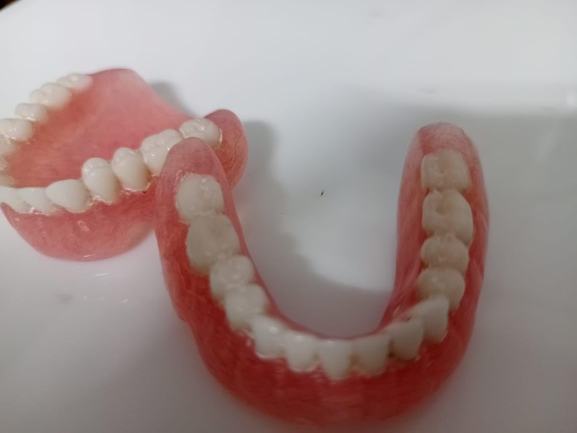 Full Set Upper & Lower Denture S591